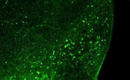 Neuron：特殊痛敏肽神經(jīng)元竟會讓人體對高脂肪食物十分偏愛